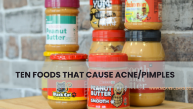 10 Foods That Cause Acne/Pimples