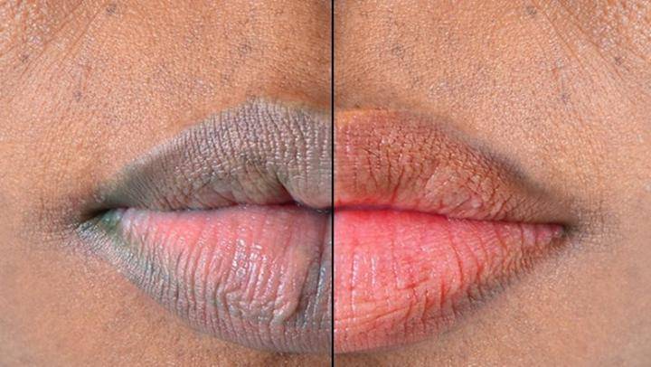 8 Tips To Naturally Make Your Lips Pink Or Brighter